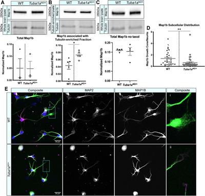 Bridging the Gap: The Importance of TUBA1A α-Tubulin in Forming Midline Commissures
